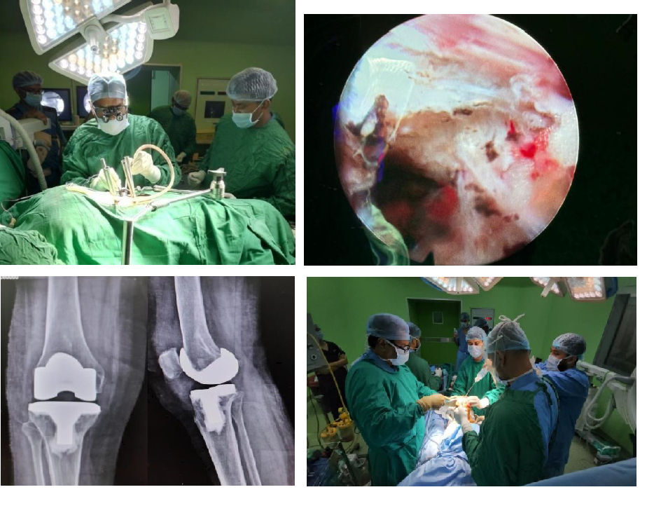 Intra Operative Pictures of Surgery