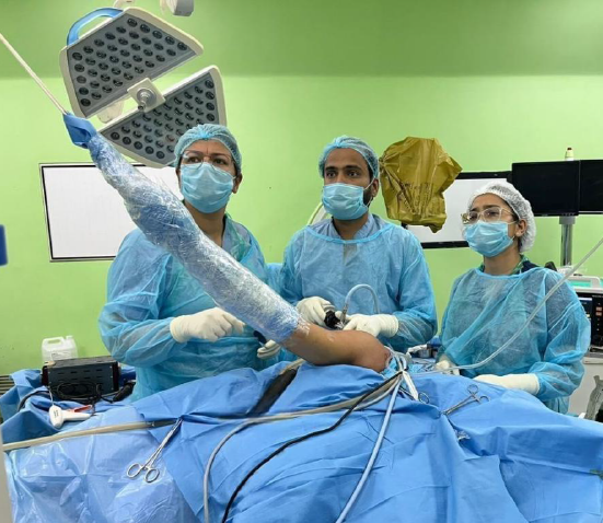 Intraoperative photograph of Shoulder Arthroscopy